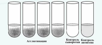 Microbiology Serological Responses