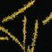 Slow Virus Infections Microbiology