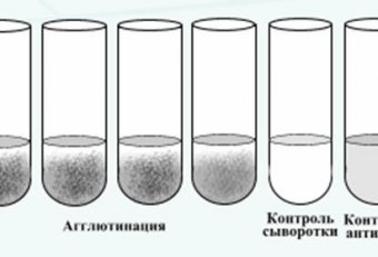 Microbiology Serological Responses