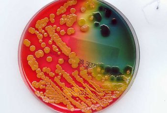 Challenges And Microbiology Sections
